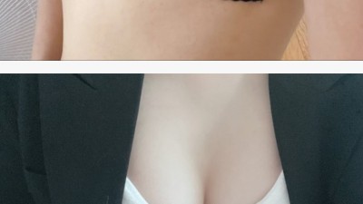 ㄹㅇ 돈이 안아깝다는 가슴수술